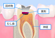 ドッグベストセメント