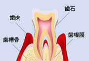 歯周病治療